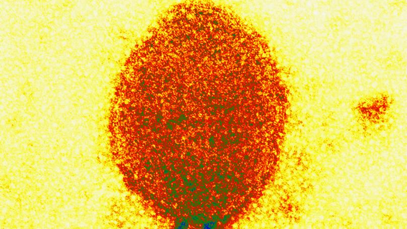 Lab Virus Loss in Australia Raises Biosafety Concerns