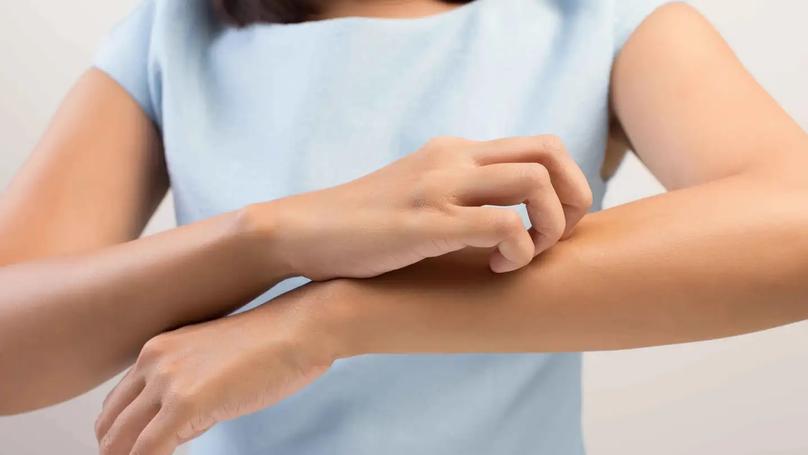 Food Allergies: A Complex Journey Through Late-Onset Symptoms